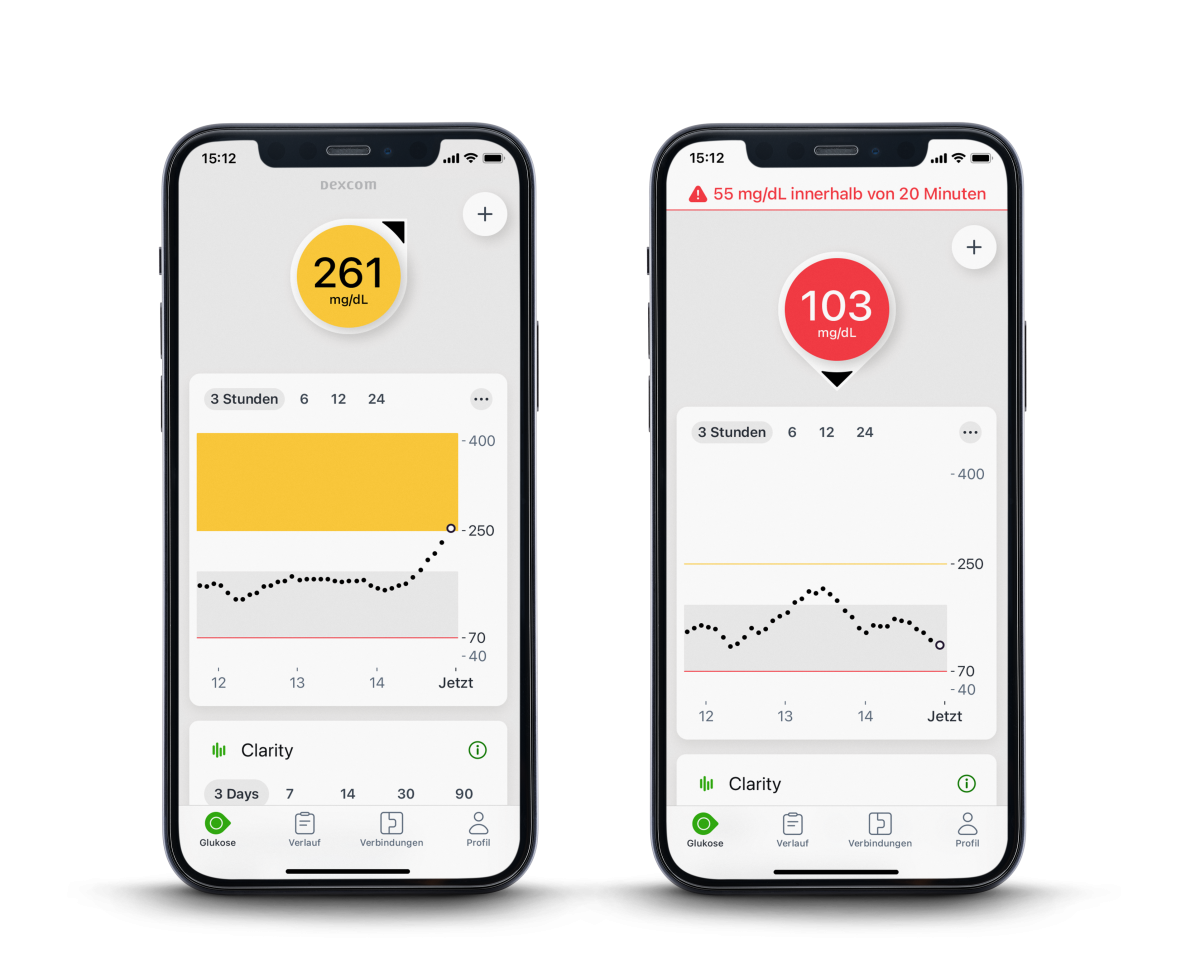 Warnungen vor hohem Glukosewert und Einstellungen für Warnungen in der Dexcom G7-Applikation