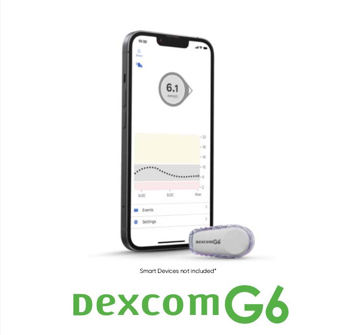 Dexcom G6: In-depth Review