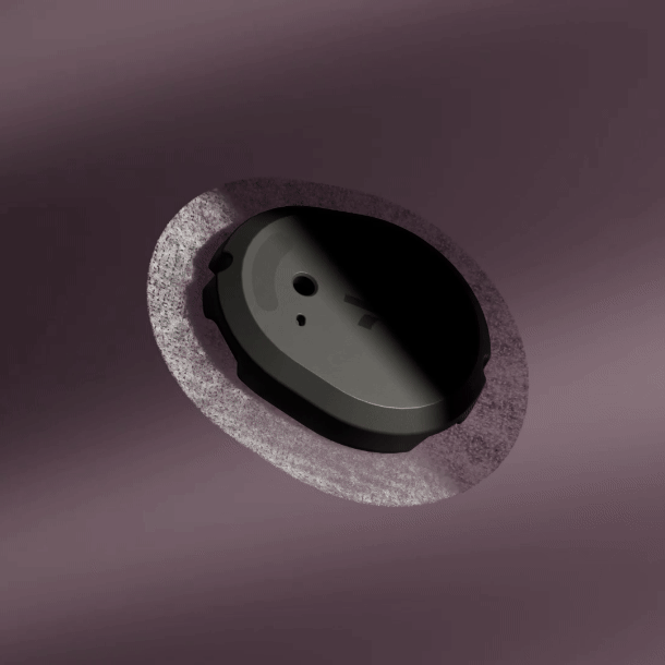 Stelo wearable biosensor